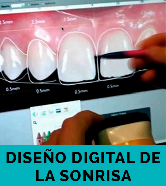 Diseño Digital de la Sonrisa en clínica Dental Sedona