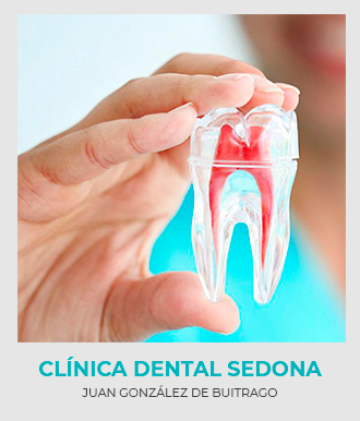 Endodoncia en Clinica Dental Sedona