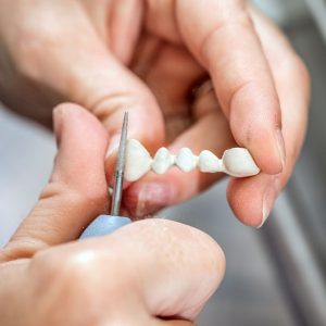 implantes dentales molares